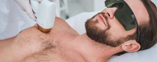 Laser Hair Removal