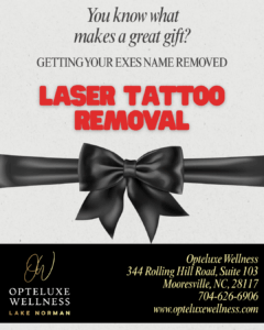 Laser Tattoo Removal - opteluxewellness Laser Tattoo Removal
