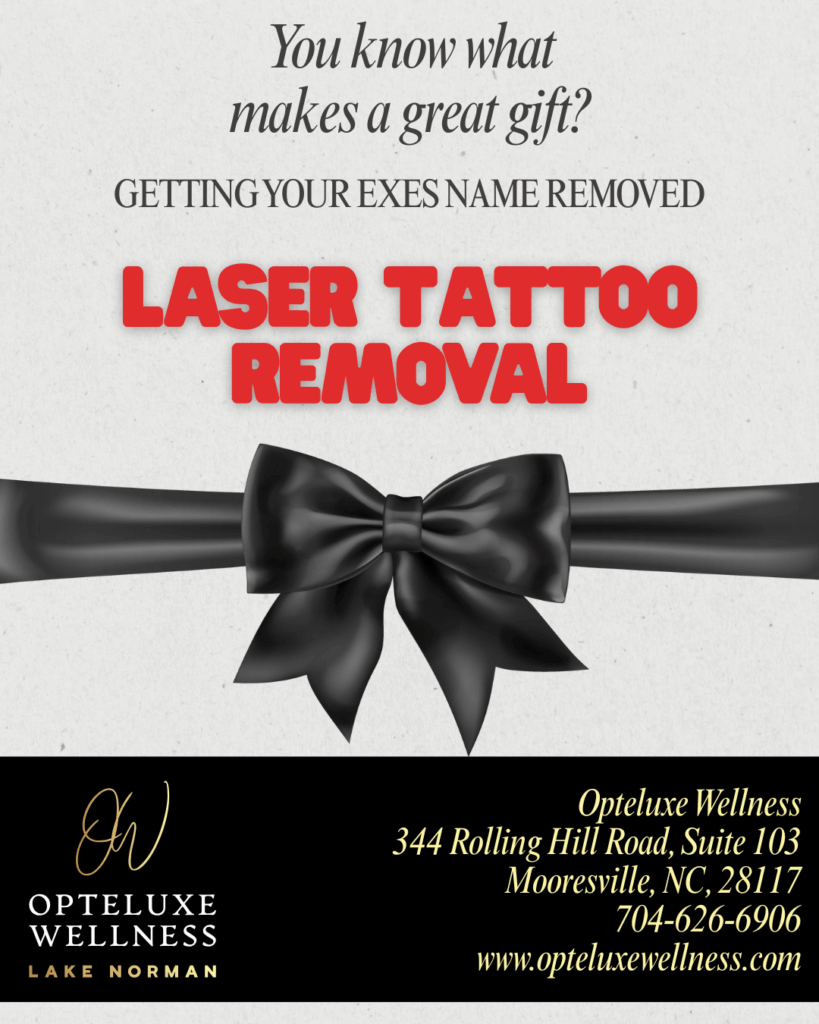 Laser Tattoo Removal