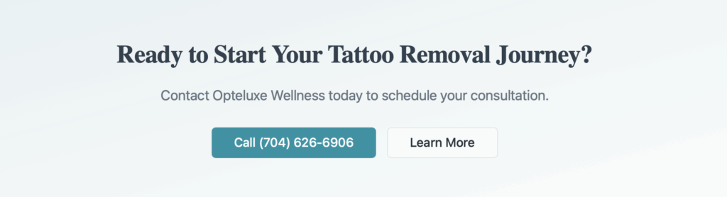 Laser Tattoo Removal - opteluxewellness Laser Tattoo Removal